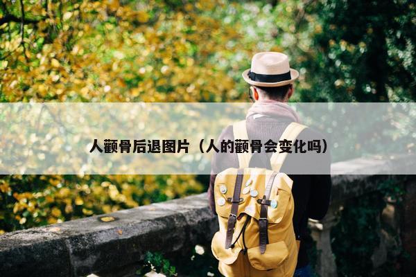 人颧骨后退图片(人的颧骨会变化吗)